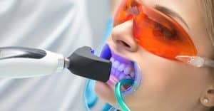 dentistry-and-teeth-whitening