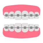 Orthodontic Consideration