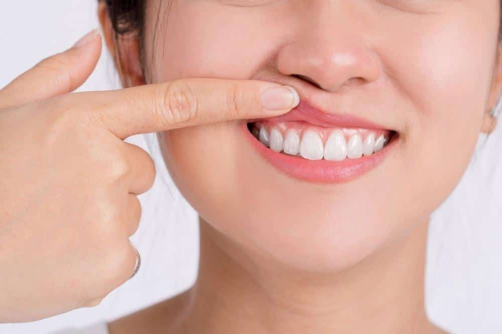 People Who Have Sensitive Teeth or Gums.