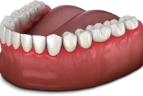 Inflamed, infected or bleeding gums.