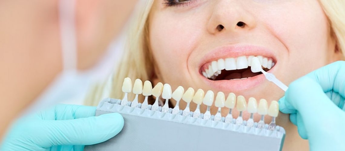dental crown procedure and care