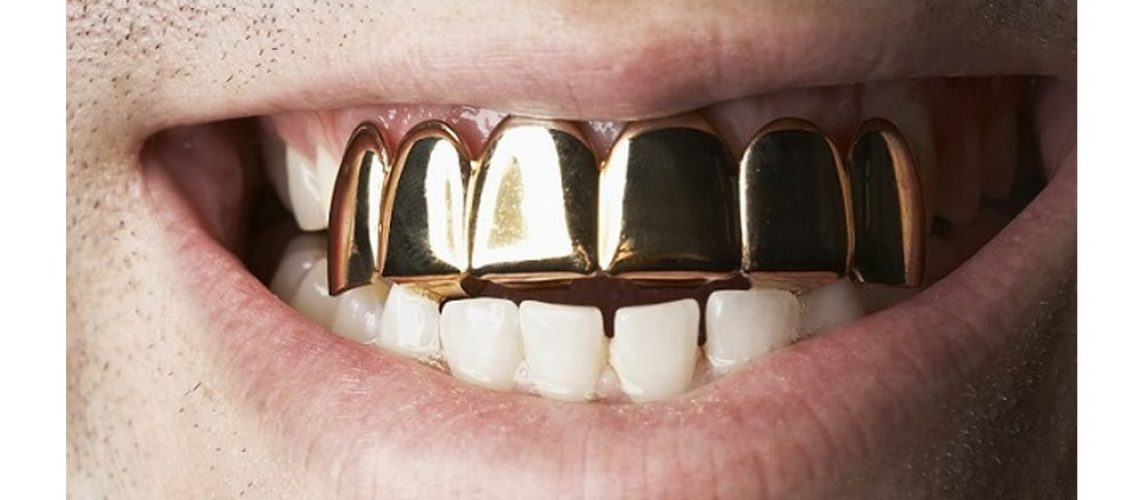gold-teeth